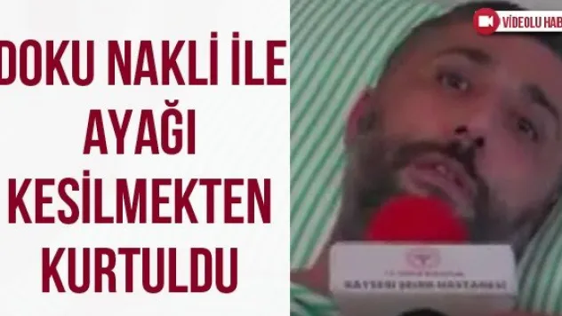 Doku Nakli İle Ayağı Kesilmekten Kurtuldu