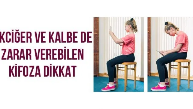 Akciğer Ve Kalbe De Zarar Verebilen KİFOZA Dikkat