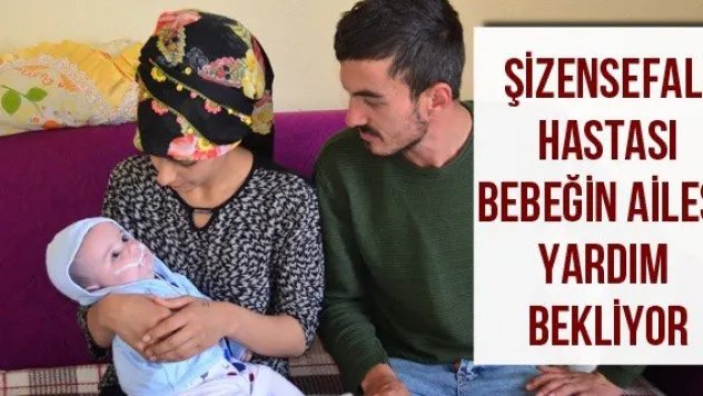 Şizensefali hastası bebeğin ailesi yardım bekliyor