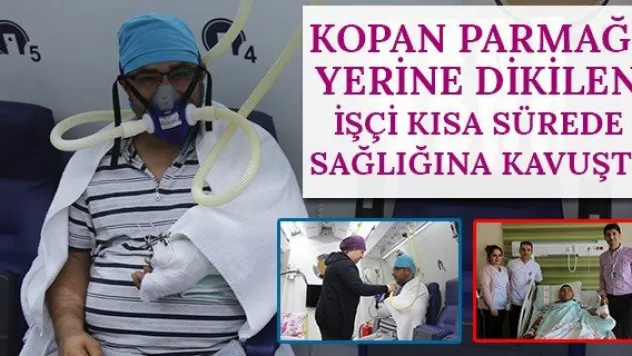 Kopan Parmağı Yerine Dikilen İşçi Kısa Sürede Sağlığına Kavuştu