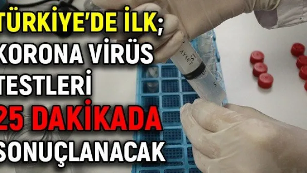 Türkiye'de ilk korona virüs testleri 25 dakikada sonuçlanacak
