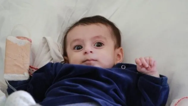 5 Aylık Bebeğin Kalbindeki Doğuştan İki Delik Cerrahisiz Yöntemle Kapatıldı 