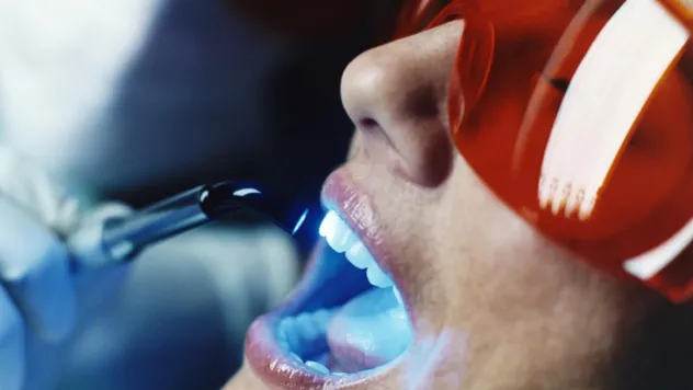 Diş beyazlatma ile sağlıklı gülüşler