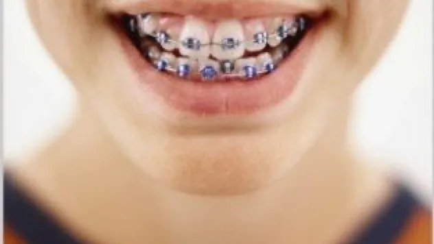 DİŞ VE ÇENE BOZUKLUKLARI