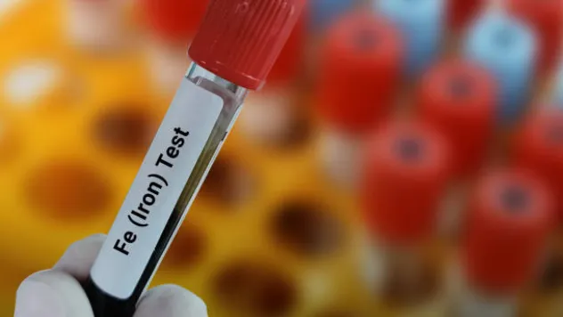 Düşük kan değerleri anemiyi işaret ediyor: Erken teşhis önemli