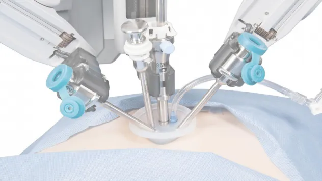 Robotik cerrahi ve yapay zeka ile diz ve kalça kireçlenmesi olan daha hızlı iyileşiyor