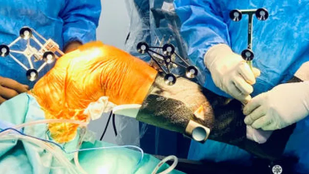 Robotik Diz Protezi Ameliyatının 5 önemli avantajı