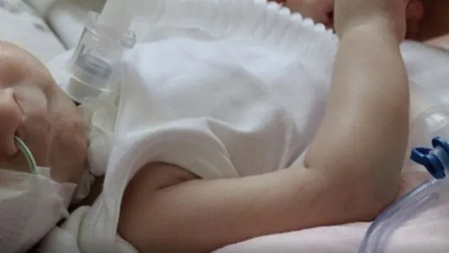 SMA hastalığı nedir?