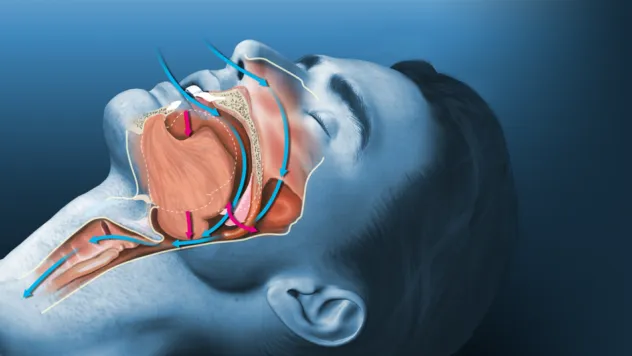 Uzmanlar uyardı: 'Uyku apnesi ciddi kazalara yol açabilir'
