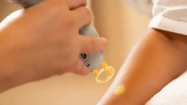 Uzmanlar uyardı: Lazer epilasyon benlere zarar verebilir