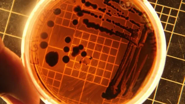 Yaz sıcağında süt ve süt ürünlerine dikkat: Uzmanlardan gıda zehirlenmesi uyarısı