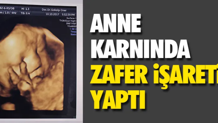 ANNE KARNINDA ZAFER iŞARETi YAPTI