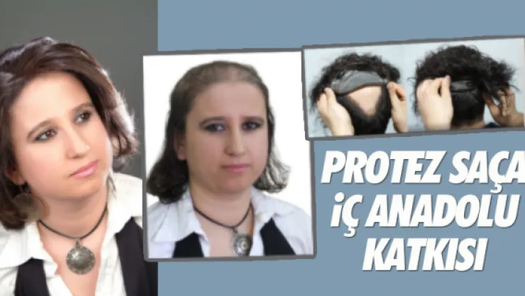 Protez saça İç Anadolu katkısı 
