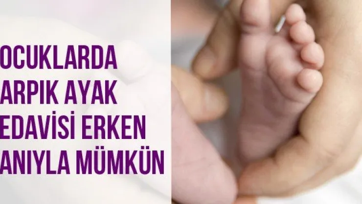 Çocuklarda Çarpık Ayak Tedavisi Erken Tanıyla Mümkün