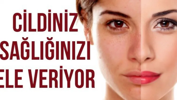 Cildiniz Sağlığınızı Ele Veriyor