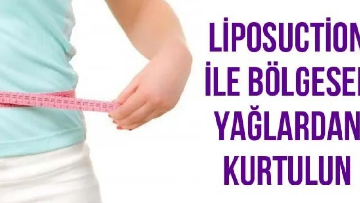 Liposuction ile bölgesel yağlardan kurtulun