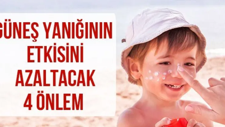 Güneş  yanığının etkisini azaltacak 4 önlem