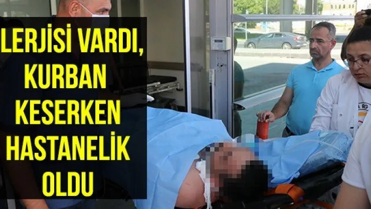 Alerjisi vardı, kurban keserken hastanelik oldu