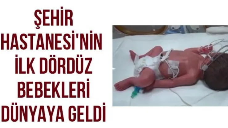 Şehir Hastanesi'nin ilk dördüz bebekleri dünyaya geldi