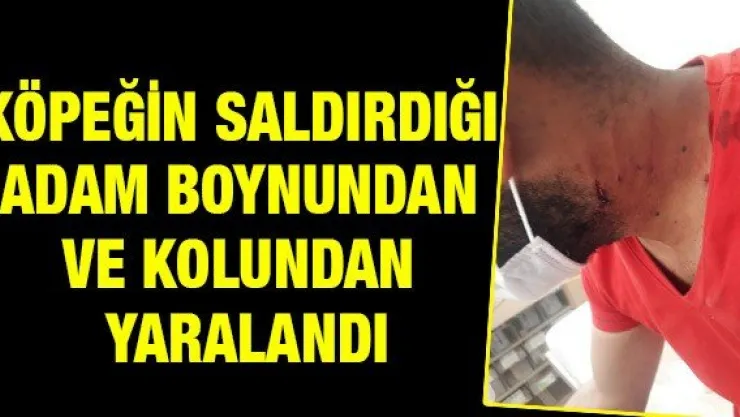 Köpeğin saldırdığı adam boynundan ve kolundan yaralandı