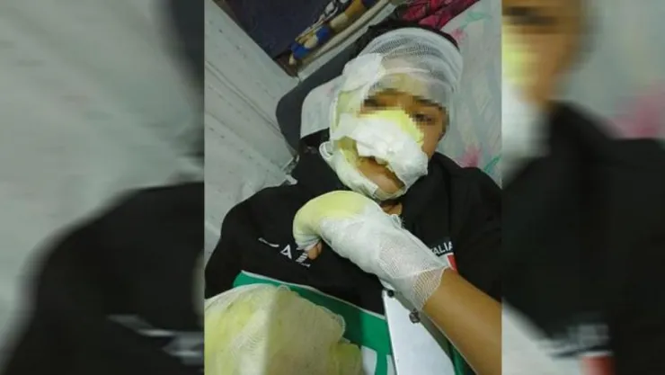 Arkadaşları tarafından fırına kilitlenen genç yanarak yaralandı: Olayın ardında ne var?