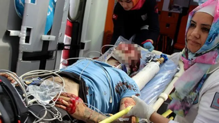 Av tüfeği ile başından vurulan 1 kişi ağır yaralandı