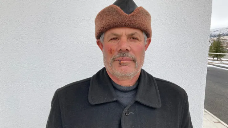 Domuzu telefonuyla çekerken saldırıya uğradı