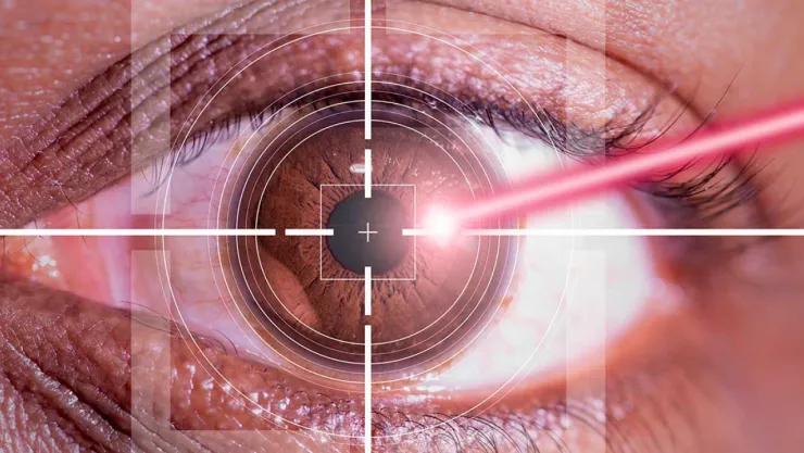 Lazer tedavisinden sonra görme netliği ne zaman kazanılır?