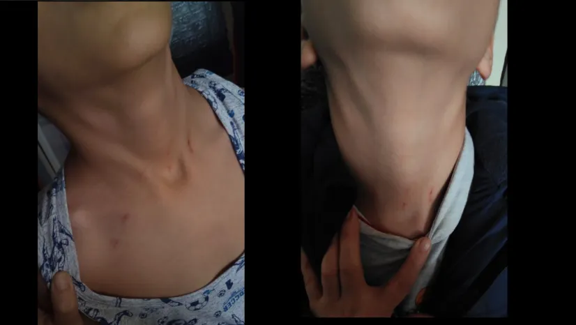 9 yaşındaki öğrenciden sınıf öğretmeni hakkında darp iddiası