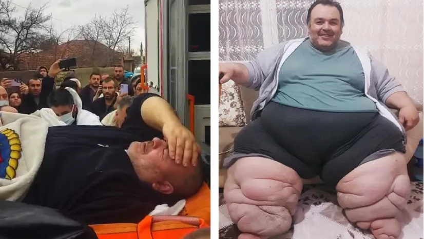 Engin Akbadal'ın Fil Hastalığı İçin Ankara'ya Sevk Edilmesi