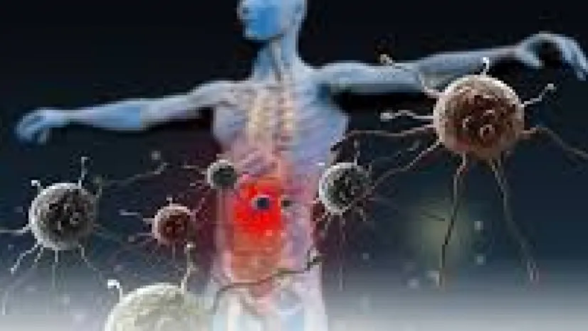 Hareketsizlik, Alkol ve Sigara, Kolon Kanseri Riskini Artırıyor