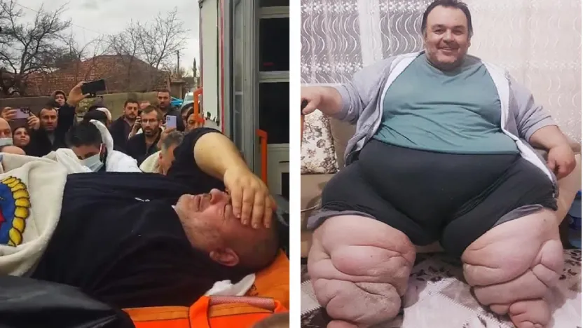 Engin Akbadal'ın Fil Hastalığı İçin Ankara'ya Sevk Edilmesi