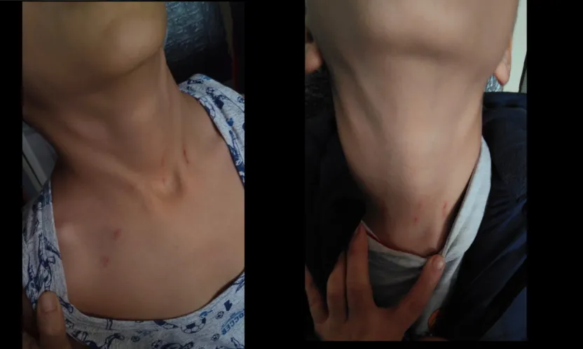 9 yaşındaki öğrenciden sınıf öğretmeni hakkında darp iddiası