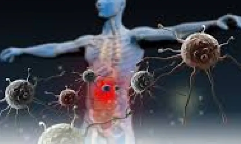 Hareketsizlik, Alkol ve Sigara, Kolon Kanseri Riskini Artırıyor