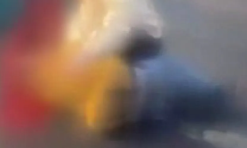 Otomobilin çarptığı 18 yaşındaki genç ağır yaralandı